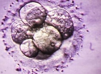 杭州哪个医生做试管比较好_杭州哪个医生做试管比较好，耗时和费用